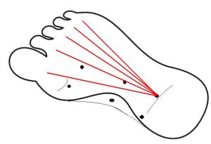 The Chiang Mai 5 lines of the sole.