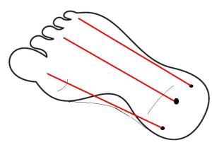 The Wat Po 3 lines of the sole.